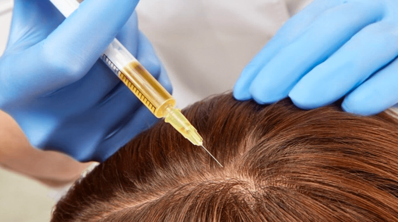 hair loss treatments